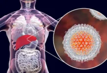 Julho Amarelo: Conscientização sobre as Hepatites Virais no Brasil